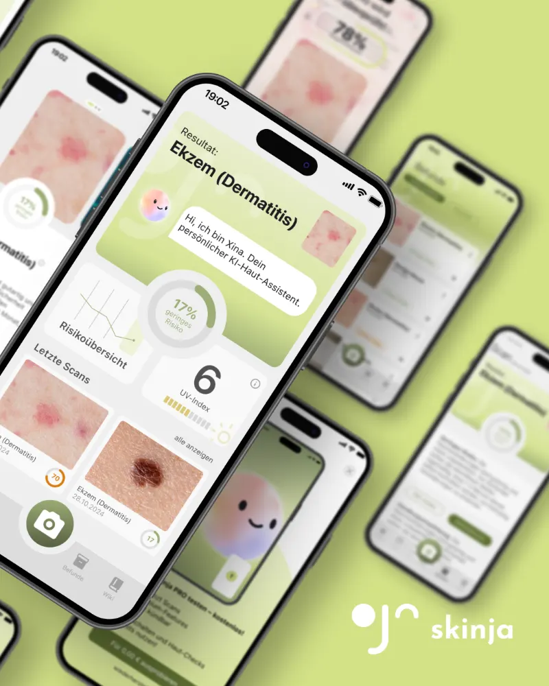 Projekt skinja – KI-gestützte Hautanalyse