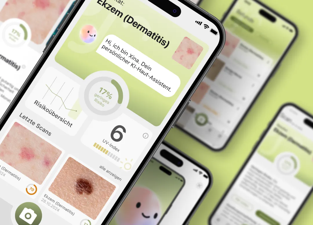 Screens des Figma-Prototyps von skinja