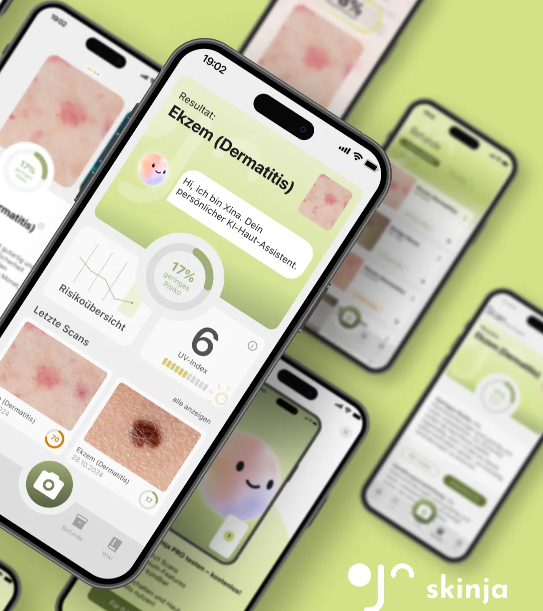 skinja KI-Hautanalyse-App auf dem Smartphone